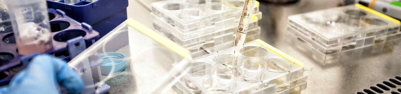 DrPH student tackles Ebola and the plague—and dissertation